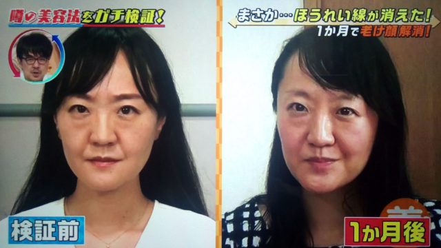 【この差って何ですか？】ほうれい線を消す美容法で老け顔が解消できるかガチ検証