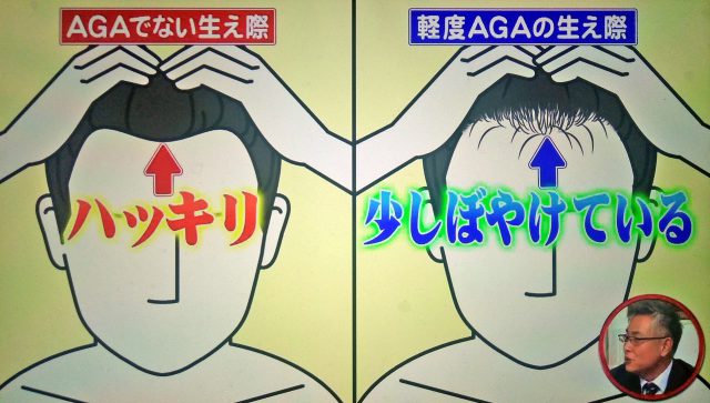 【ホンマでっかTV】令和の最新美容整形SP｜薄毛治療・歯列矯正・プチ整形の新常識ベスト10