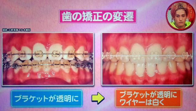 【ホンマでっかTV】令和の最新美容整形SP｜薄毛治療・歯列矯正・プチ整形の新常識ベスト10