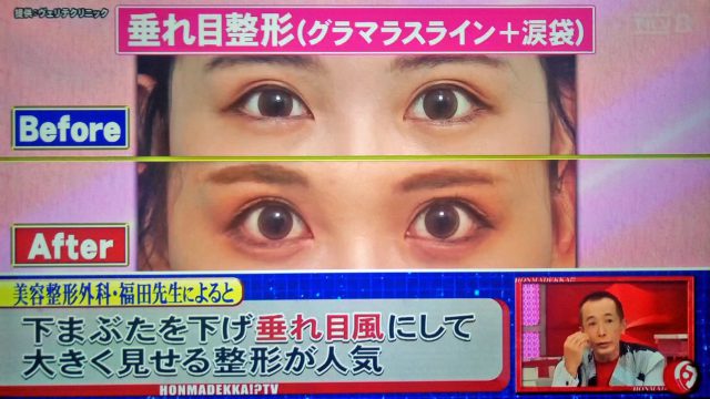 【ホンマでっかTV】令和の最新美容整形SP｜薄毛治療・歯列矯正・プチ整形の新常識ベスト10